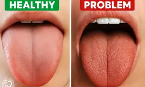 Gesunde Zunge (links) vs. Zunge mit Problemen (rechts). Tipps zur **Speichelproduktion anregen** für ein gesundes Mundgefühl.
